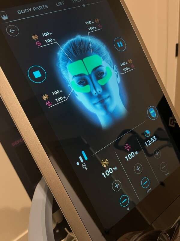 Body contouring treatment at AZ Vitality and Wellness