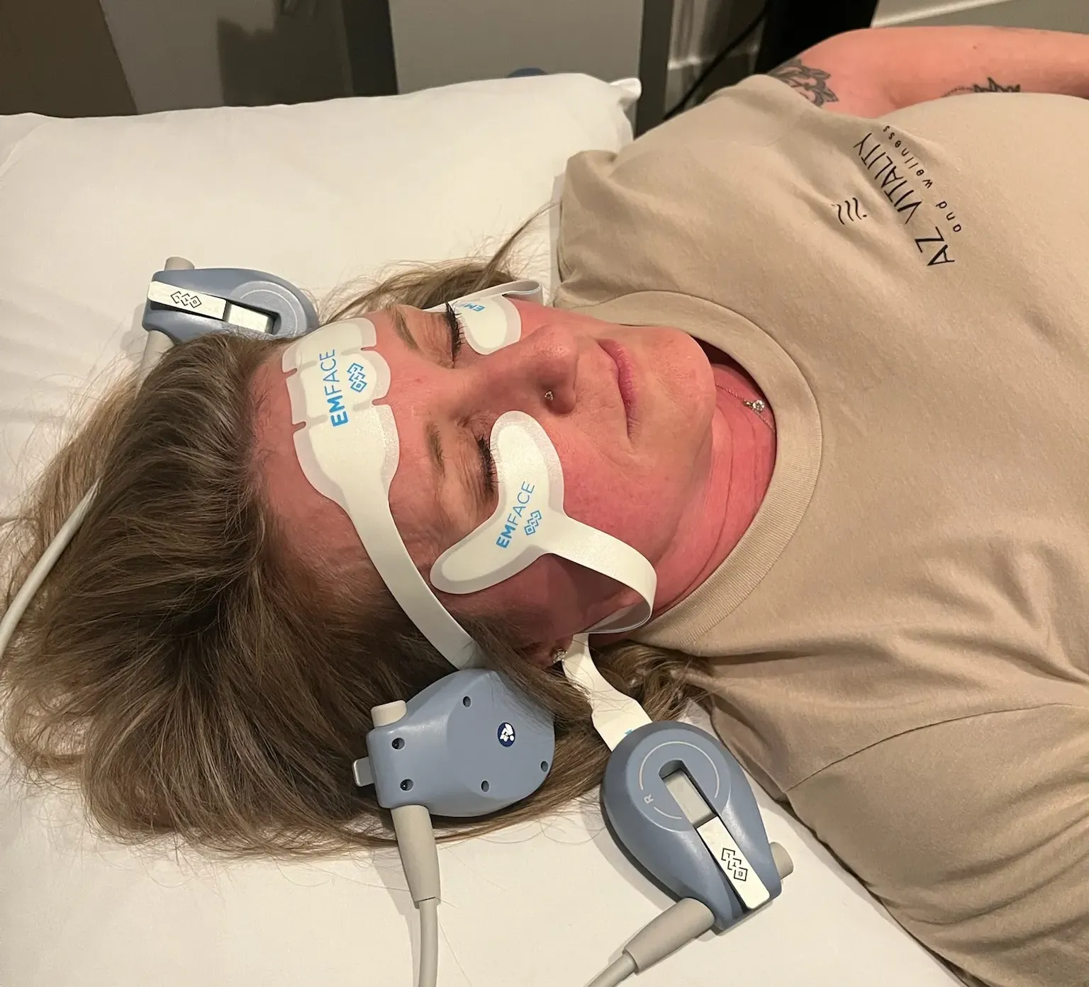 Female receiving Emface treatment to tighten facial skin.